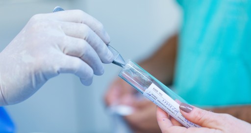 Prostatabiopsie: Analyse der Zellen im Labor Prostata Hilfe Deutschland: Frau mit Röhrchen im Labor