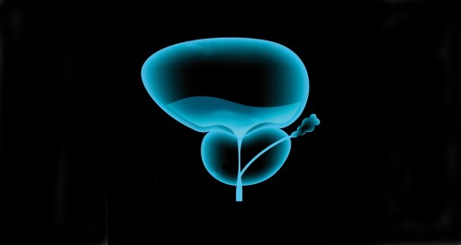 Prostata Hilfe Deutschland: Grafik einer vergrößerten Prostata