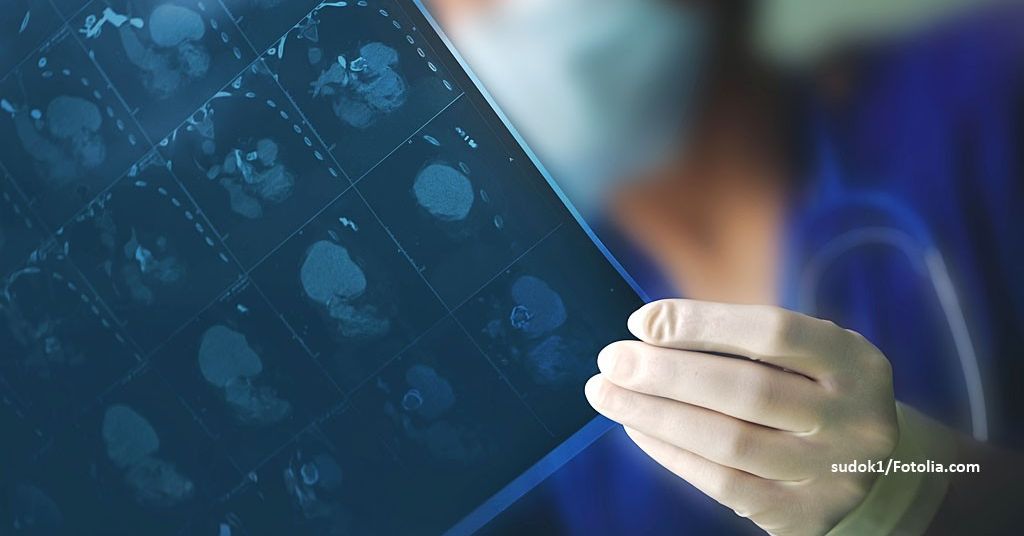 Prostata Hilfe Deutschland: Illustrationsbild - Arzt mit Computertomographie-Bildern